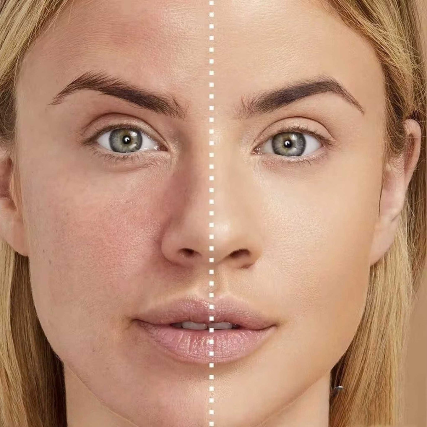 Before and after effect of Oplenza Natural Finish Cream Concealer on a model face