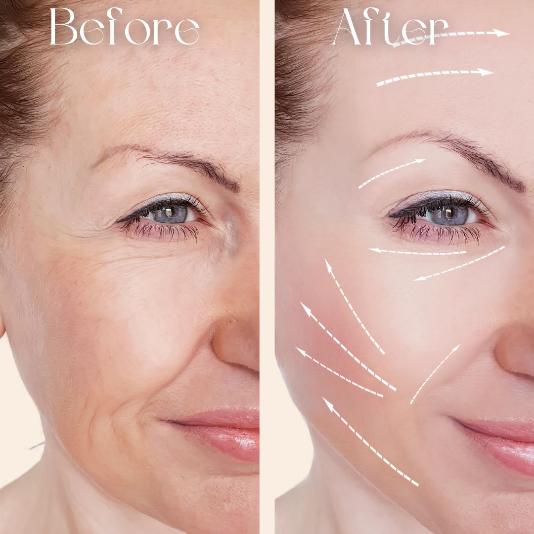 Before and after comparison of Oplenza face and neck massager device, best handheld facial massager device