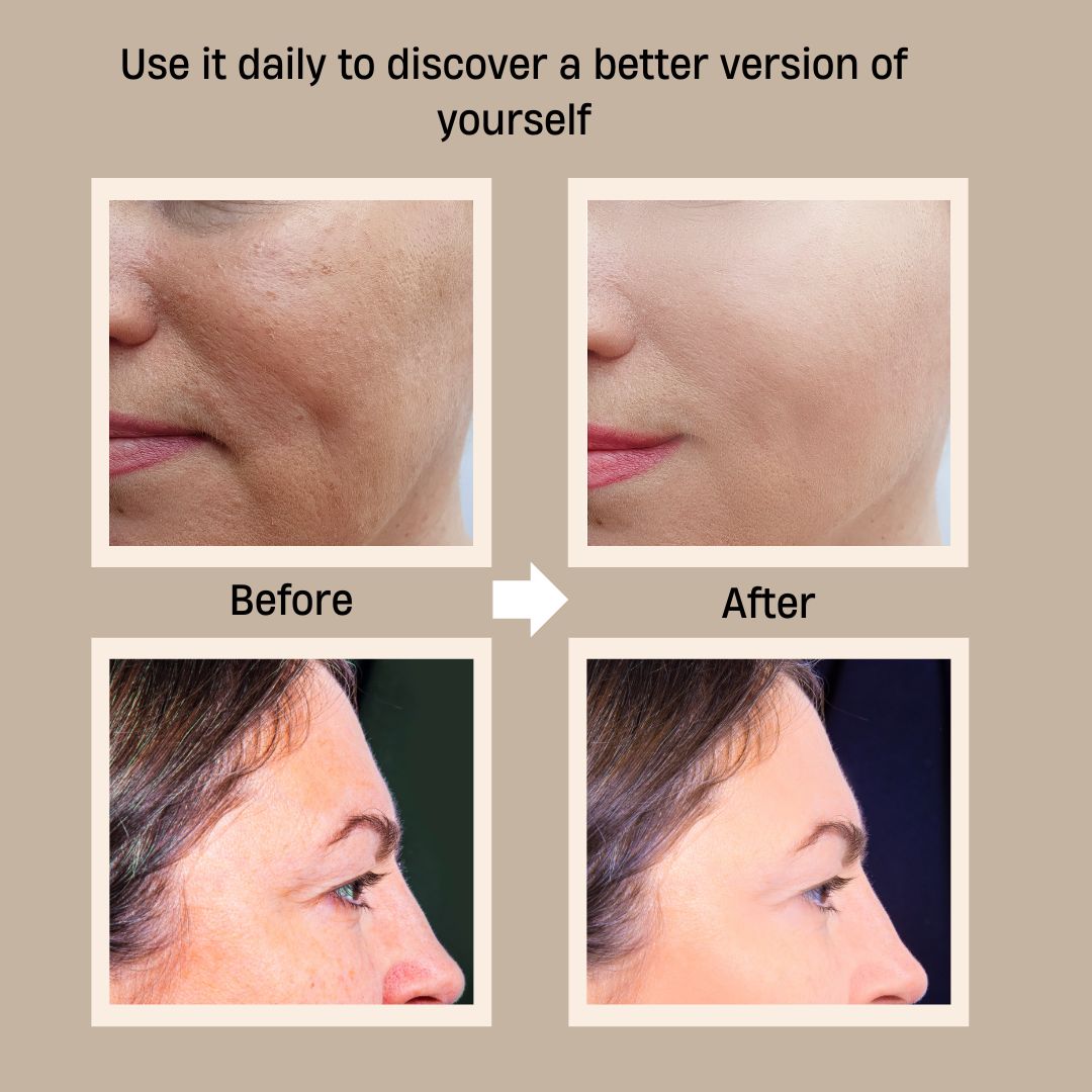 Before and after skincare results from Oplenza skincare wand - Soft Taupe, White 